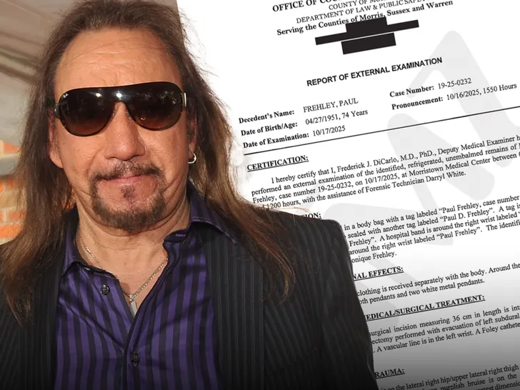 Rock Legend Ace Frehley, Cause of Death Revealed Accidental Fall