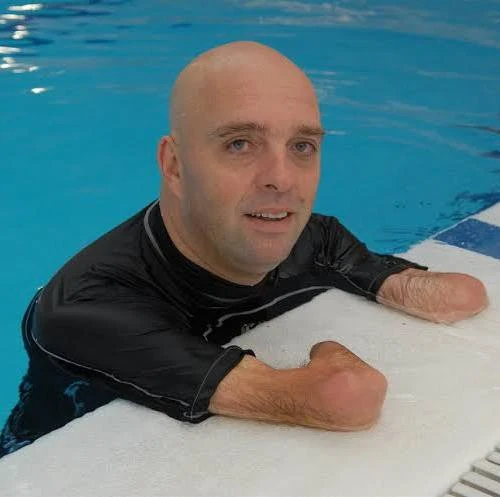 From Tragedy to Triumph How Philippe Croizon Turned a Life-Altering Accident into a Global Legacy